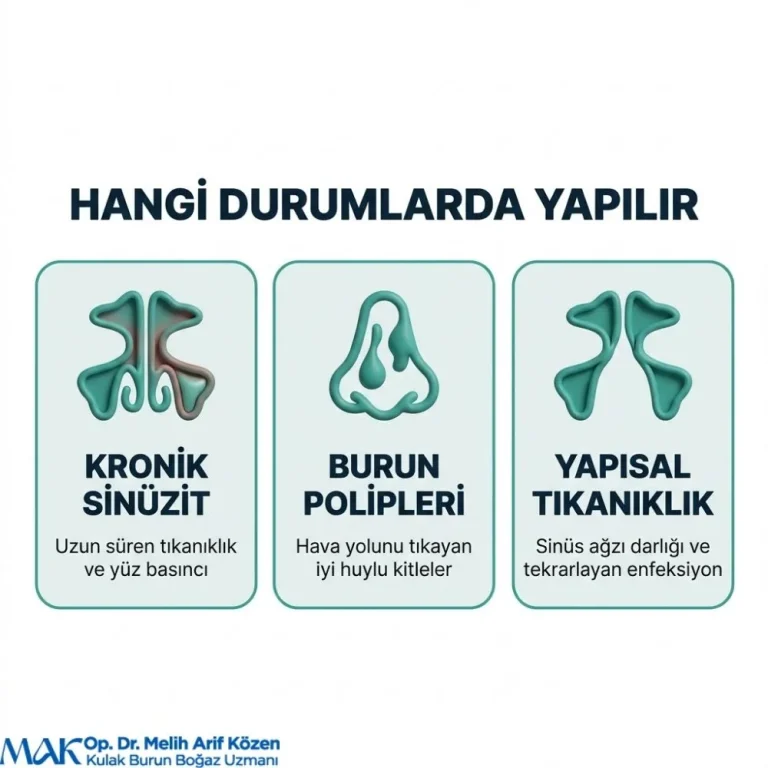 Alsancak Endoskopik sinus cerrahisi yorumları