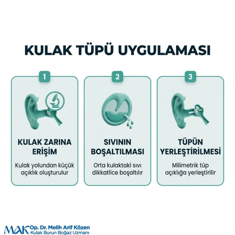 Alsancak Kulak tüpü ne kadar kalmalı