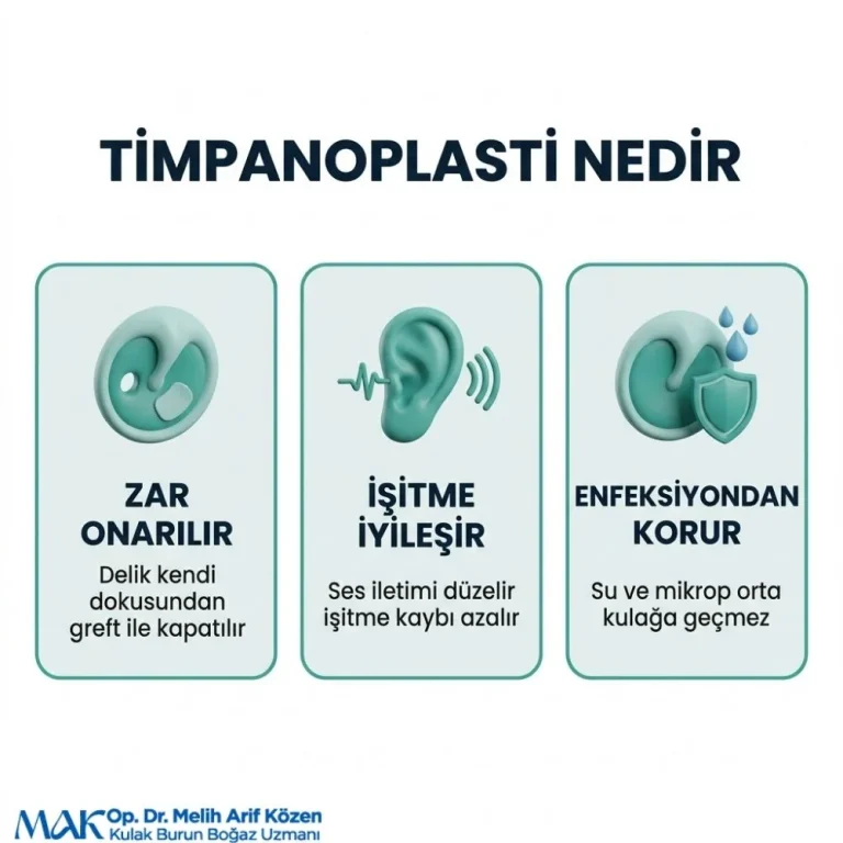 Alsancak Timpanoplasti ameliyatı olanların yorumları